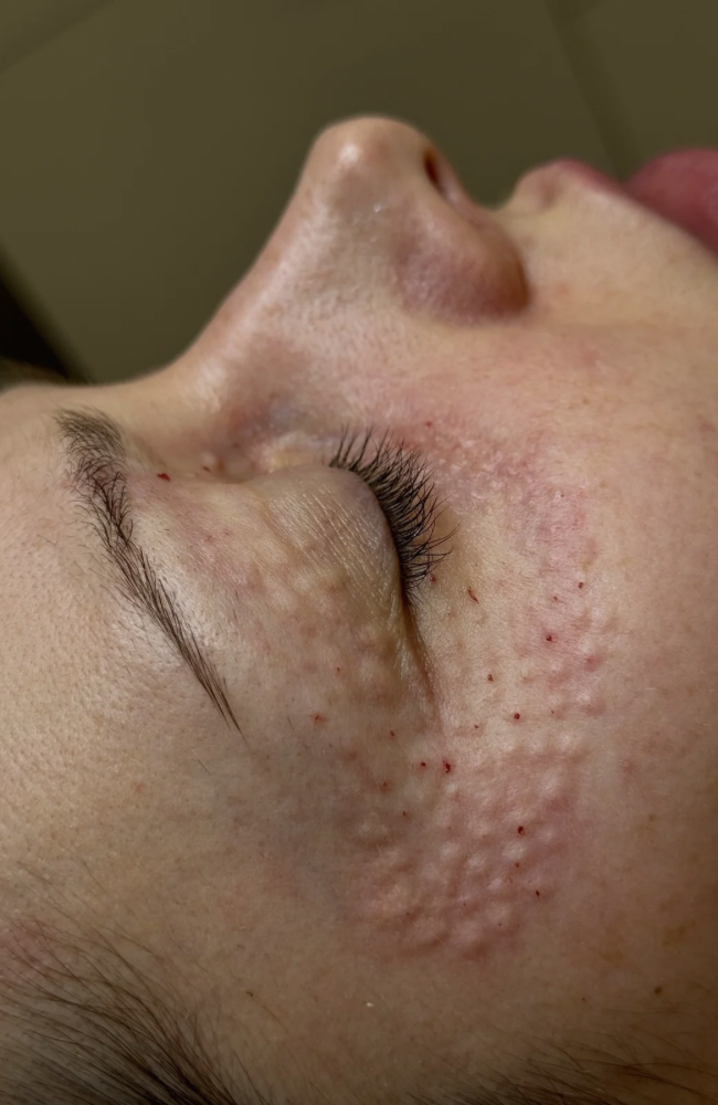 beliebte behandlungen dia home polynukleotide beliebte behandlungen